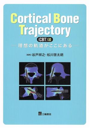 Cortical Bone Trajectory(CBT)法 理想の軌道がここにある