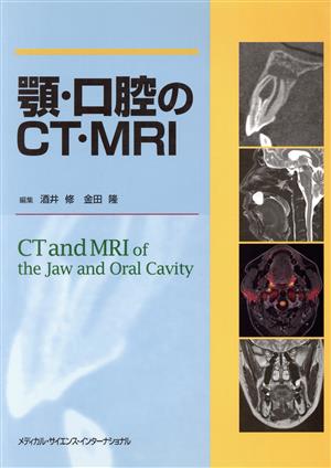 顎・口腔のCT・MRI