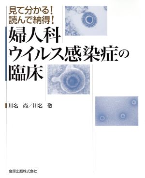 見て分かる！読んで納得！婦人科ウイルス感染の臨床