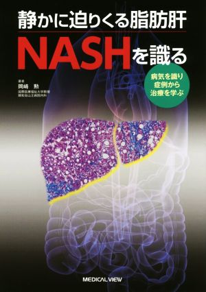 静かに迫りくる脂肪肝NASHを識る 病気を識り症例から治療を学ぶ