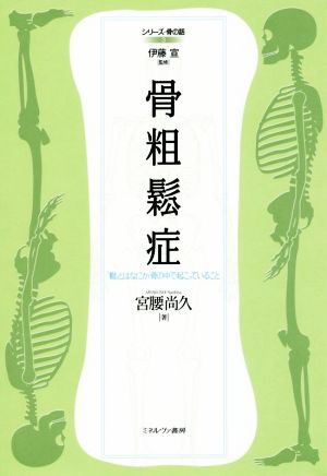 骨粗鬆症 「鬆」とはなにか、骨の中で起こっていること シリーズ・骨の話3