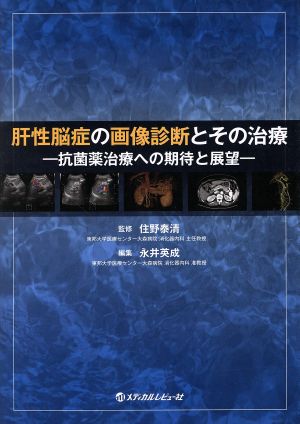 肝性脳症の画像診断とその治療 抗菌薬治療への期待と展望