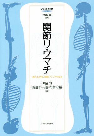 関節リウマチ 「流れる」病気、関節リウマチを知る シリーズ・骨の話2