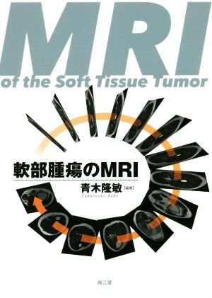 軟部腫瘍のMRI