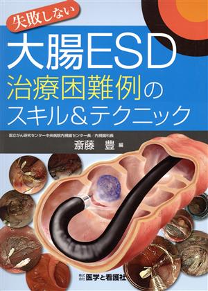 失敗しない大腸ESD治療困難例のスキル&テクニック