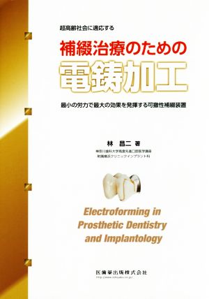 超高齢社会に適応する補綴治療のための電鋳加工 最小の労力で最大の効果を発揮する可撤性補綴装置