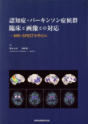 認知症・パーキンソン症候群 画像と臨床との対応 MRI・SPECTを中心に