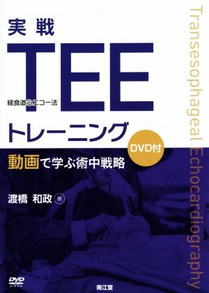 実戦TEE(経食道心エコー法)トレーニング 動画で学ぶ術中戦略