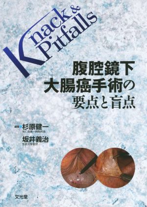 腹腔鏡下大腸癌手術の要点と盲点 Knack & pitfalls