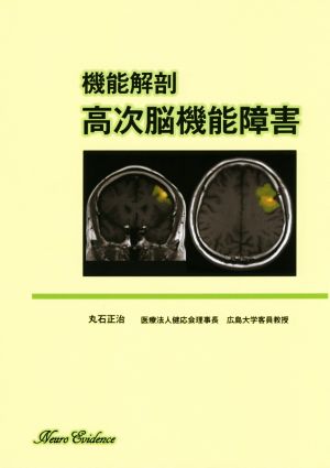 機能解剖 高次脳機能障害