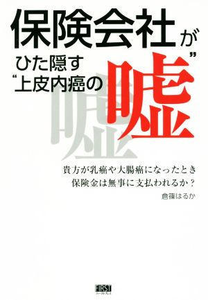 保険会社がひた隠す“上皮内癌の嘘