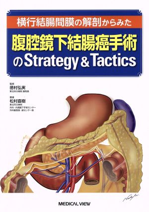 腹腔鏡下結腸癌手術のStrategy&Tactics 横行結腸間膜の解剖からみた