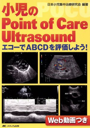 小児のPoint of Care UltrasoundエコーでABCDを評価しよう！