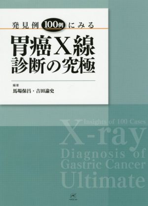 発見例100例にみる胃癌X線診断の究極