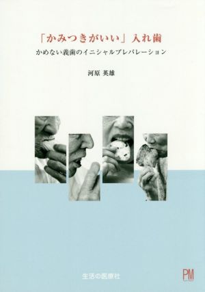 「かみつきがいい」入れ歯 かめない義歯のイニシャルプレパレーション