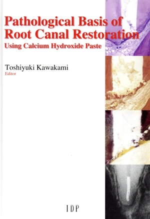 英文 Pathological Basis of Root Canal Restoration Using Calcium Hydroxide Paste