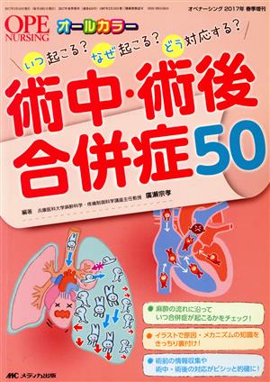 術中・術後合併症50 いつ起こる？なぜ起こる？どう対応する？