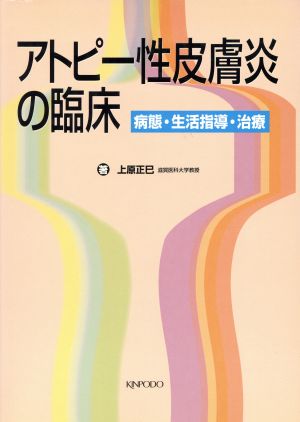 アトピー性皮膚炎の臨床 病態・生活指導・治療