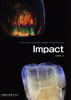 Impact Color and internal shape of Anteriores