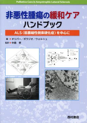 非悪性腫瘍の緩和ケアハンドブック ALS〈筋萎縮性側索硬化症〉を中心に