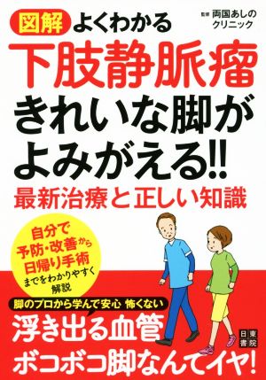 図解良くわかる下肢静脈瘤 きれいな足がよみがえる!!最新治療と正しい知識