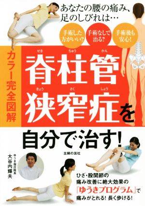 カラー完全図解 脊柱管狭窄症を自分で治す！