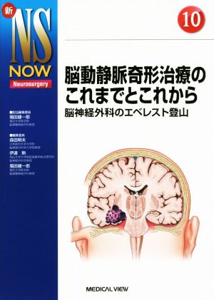 脳動静脈奇形治療のこれまでとこれから 脳神経外科のエベレスト登山 新NS NOW Neurosurgery10