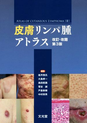 取寄 値下げ中！皮膚リンパ腫アトラス | www.alverhuur.be