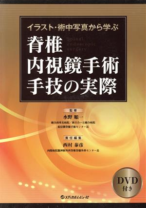 脊椎内視鏡手術手技の実際 イラスト・術中写真から学ぶ