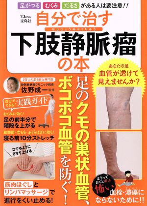 自分で治す下肢静脈瘤の本足のクモの巣状血管、ボコボコ血管を防ぐ！TJ MOOK