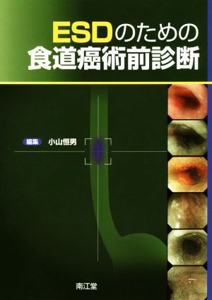 ESDのための食道癌術前診断