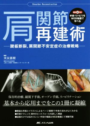 肩関節再建術 腱板断裂,肩関節不安定症の治療戦略