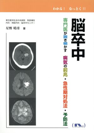 脳卒中 専門医が解き明かす 病気の前兆・急性期対応法・予防法