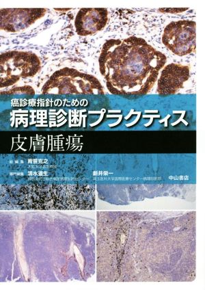 癌診療指針のための病理診断プラクティス 皮膚腫瘍