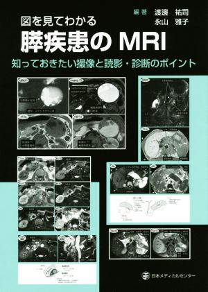 図を見てわかる 膵疾患のMRI 知っておきたい撮像と読影・診断のポイント