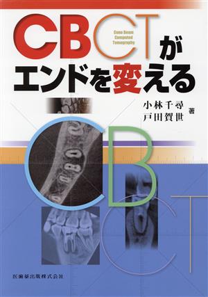 CBCTがエンドを変える