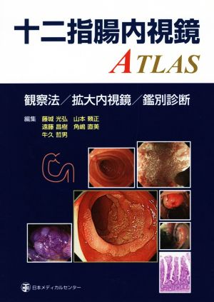 十二指腸内視鏡ATLAS 観察法/拡大内視鏡/鑑別診断
