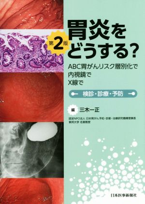 胃炎をどうする？ 第2版 ABC胃がんリスク層別化で 内視鏡で X線で 検診・診療・予防