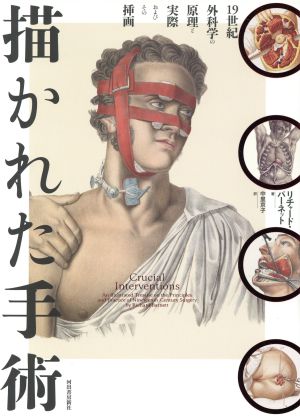 描かれた手術19世紀外科学の原理と実際およびその挿画医学博物誌シリーズ2