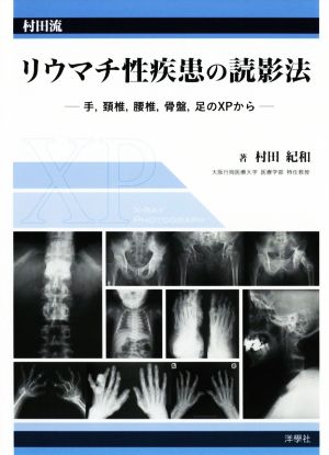 村田流リウマチ性疾患の読影法 手、頚椎、腰椎、骨盤、足のXPから