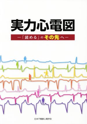 実力心電図 「読める」のその先へ