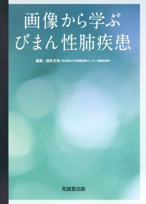 画像から学ぶびまん性肺疾患