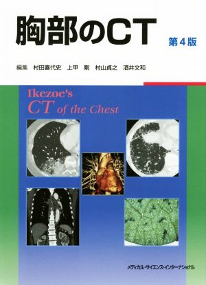 胸部のCT 第4版