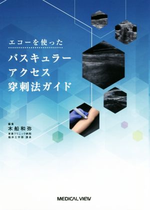 エコーを使ったバスキュラーアクセス穿刺法ガイド