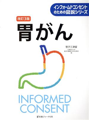 胃がん 改訂3版 インフォームドコンセントのための図説シリーズ