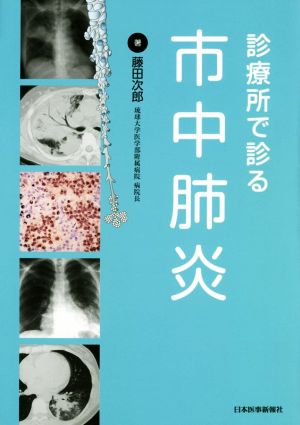 診療所で診る市中肺炎