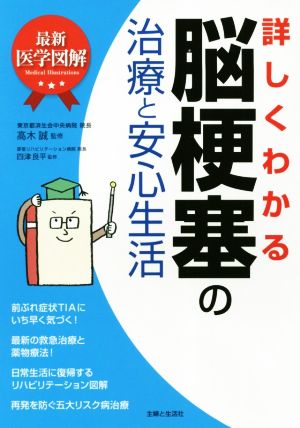 詳しくわかる脳梗塞の治療と安心生活 最新医学図解