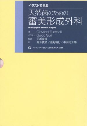 イラストで見る 天然歯のための審美形成外科