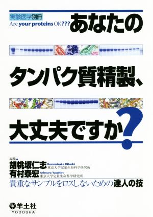 あなたのタンパク質精製、大丈夫ですか？ 貴重なサンプルをロスしないための達人の技