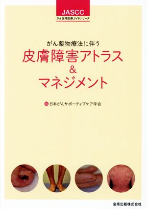 皮膚障害アトラス&マネジメント がん薬物療法に伴う